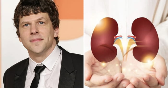 Jesse Eisenberg Reveals He Is Donating His Kidney To A Stranger