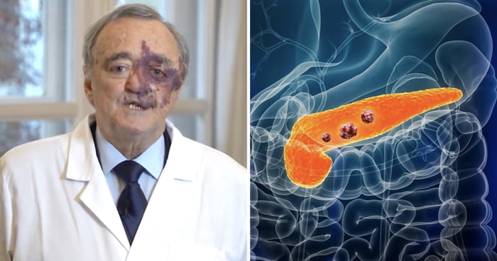Spanish Scientists Cured Pancreatic Cancer In Rats In Major Breakthrough