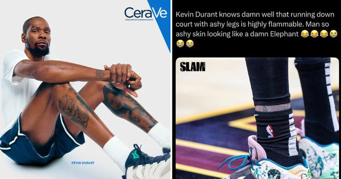 NBA Star Kevin Durant Turns Ashy Legs Meme Into Brand Deal
